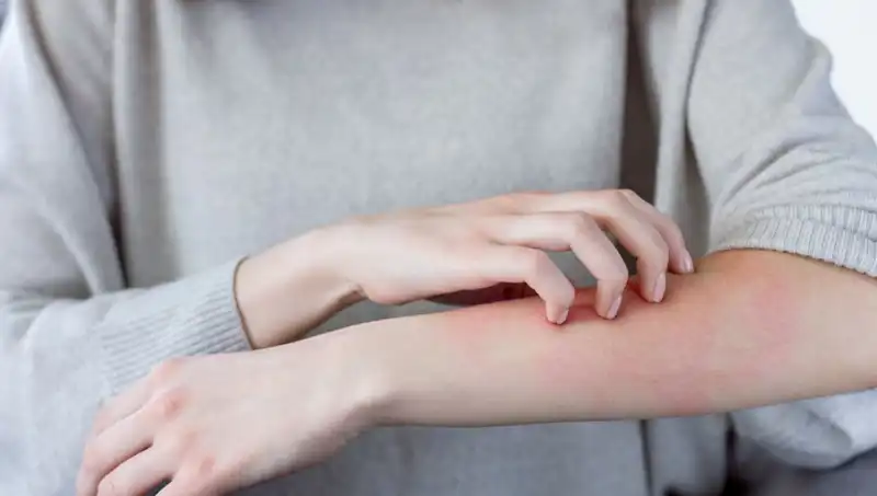 Cilt Kanserini Erken Teşhis Etmenin Yolları: Dermatolog İki Belirtinin Peşinde