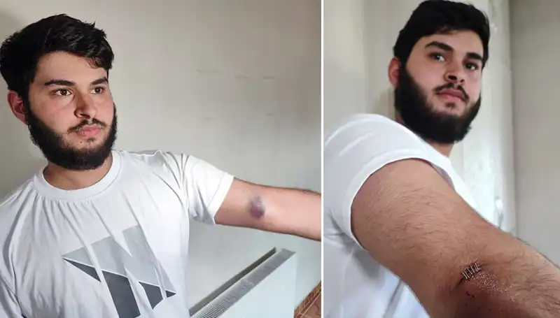 Bahçeye Kaçan Top, Mahallenin Karışmasına Neden Oldu: "Conolar Kamyonetle Geldi"