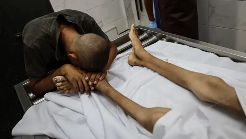 Gazze'deki Çocuklar İçin Bir Kayıp Daha: Açlıktan Ölen Masumlar